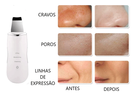 Image of Beauty Peeling Ultrassônico - Limpeza Facial